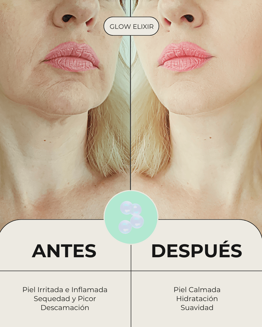 Comparativa del sérum Banbu: piel irritada antes y piel calmada, hidratada y suave después de usar Glow Elixir.