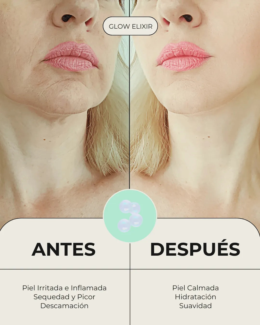 Comparativa del sérum Banbu: piel irritada antes y piel calmada, hidratada y suave después de usar Glow Elixir.