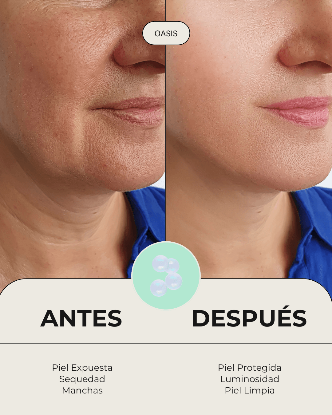 Comparativa antes y después del uso del sérum Oasis de Banbu: piel más tersa, hidratada y luminosa.