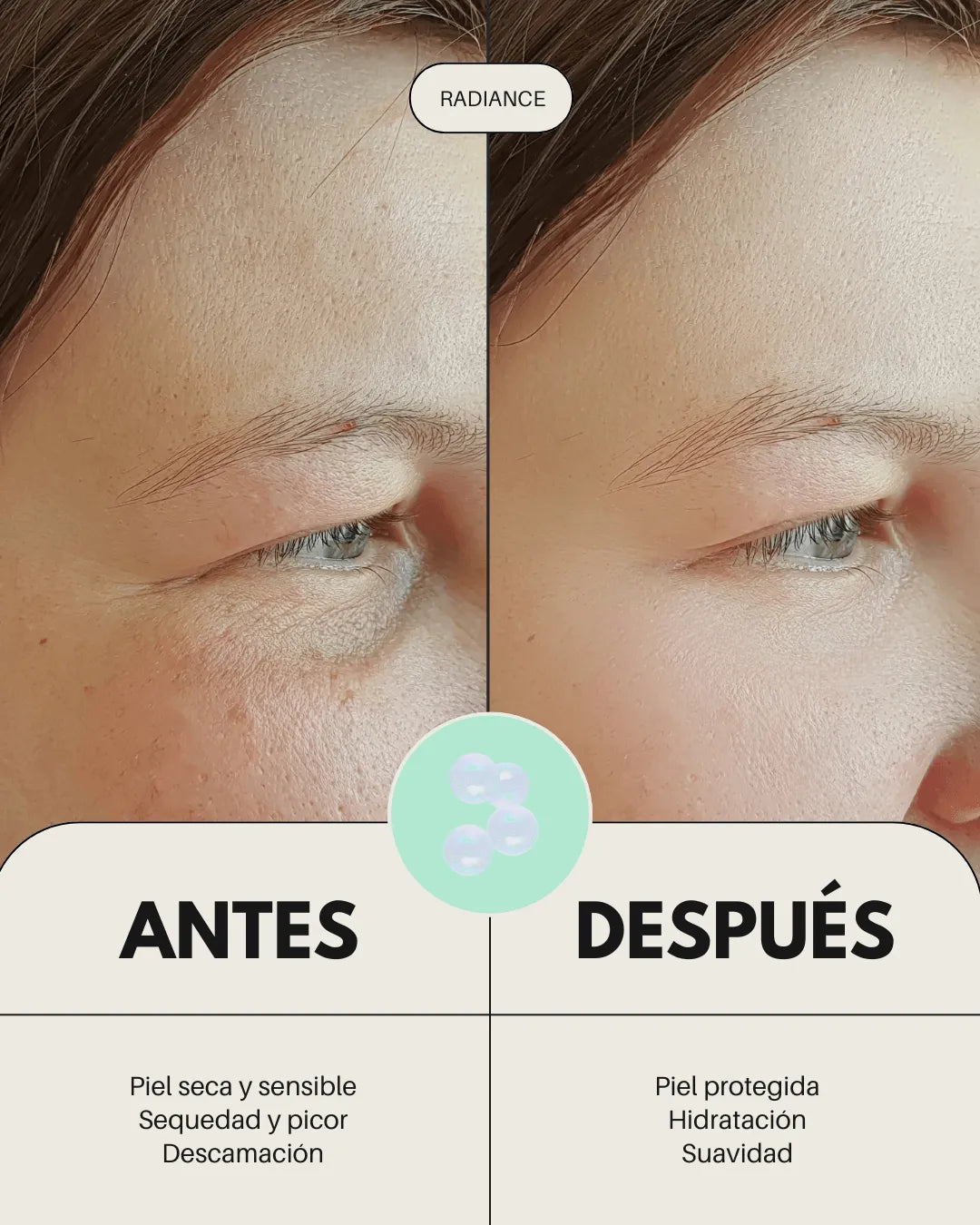 Comparativa antes y después del bálsamo Radiance de Banbu: piel más hidratada y suave tras su uso.