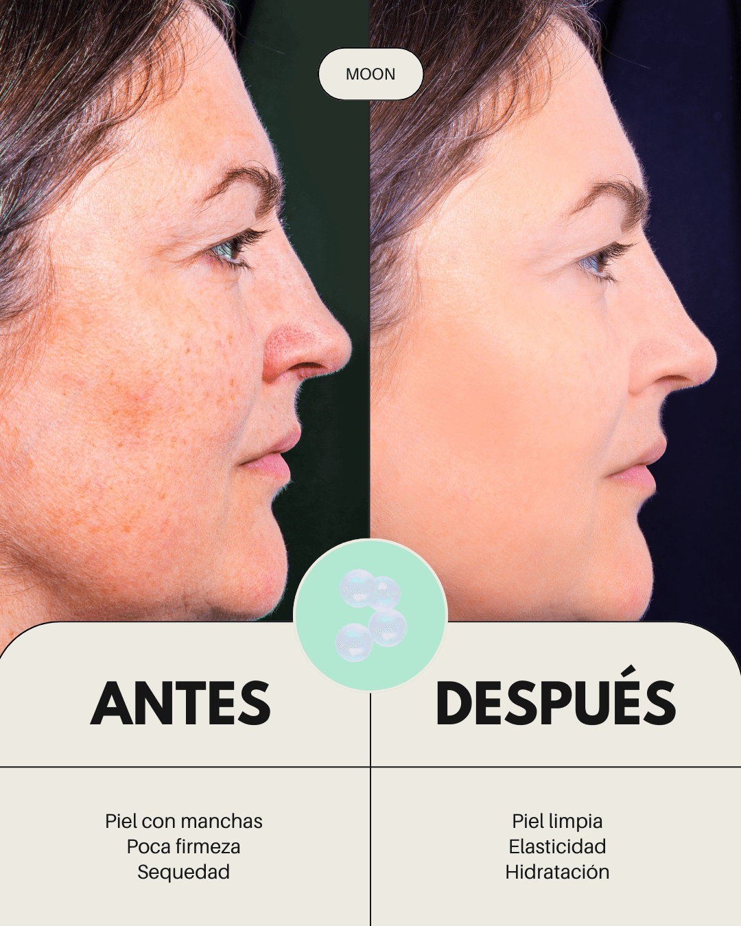 Comparativa antes y después de usar crema facial Banbu MOON: piel más uniforme, hidratada y con mayor firmeza.