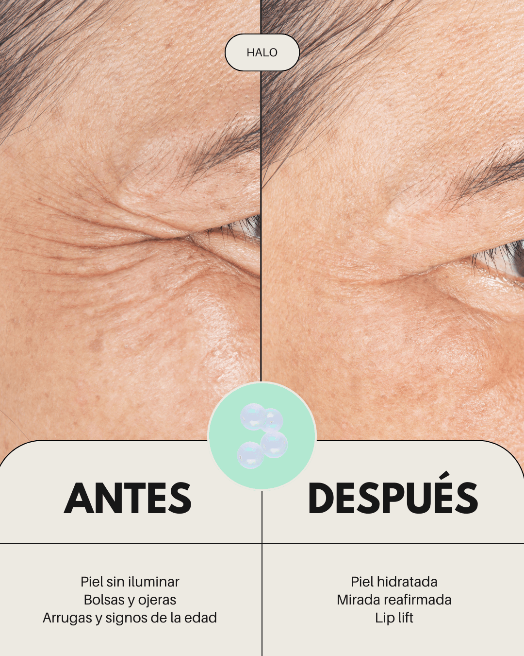 Comparativa visual de contorno de ojos antes y después de usar productos Banbu. Se aprecia una piel más reafirmada.