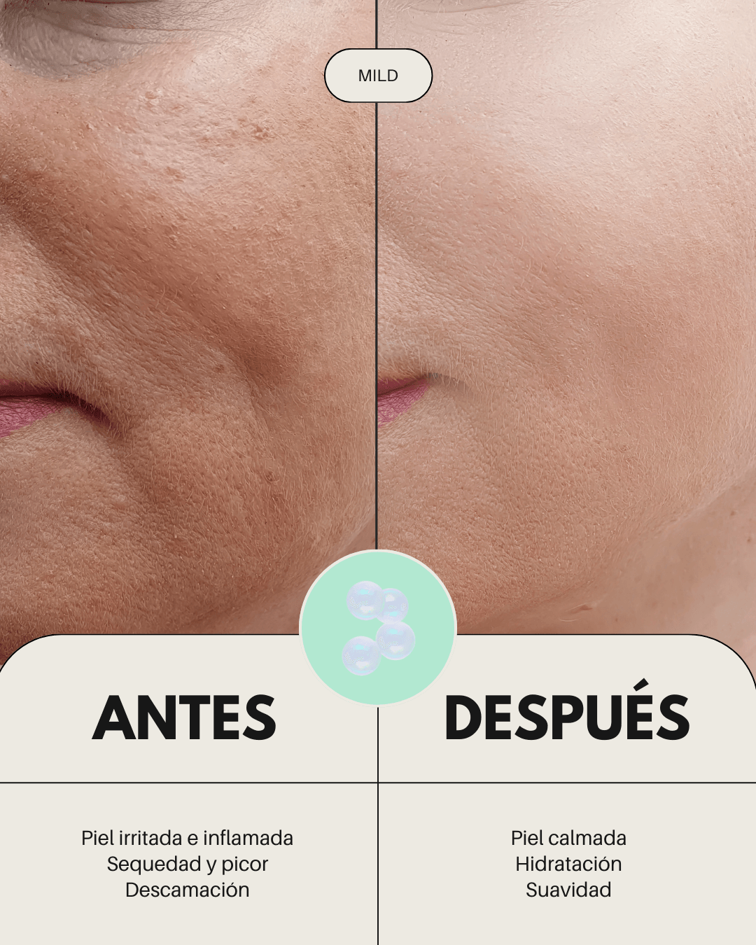 Comparativa antes y después del uso de rutina Banbu en piel sensible, mostrando una piel calmada, hidratada y suave.