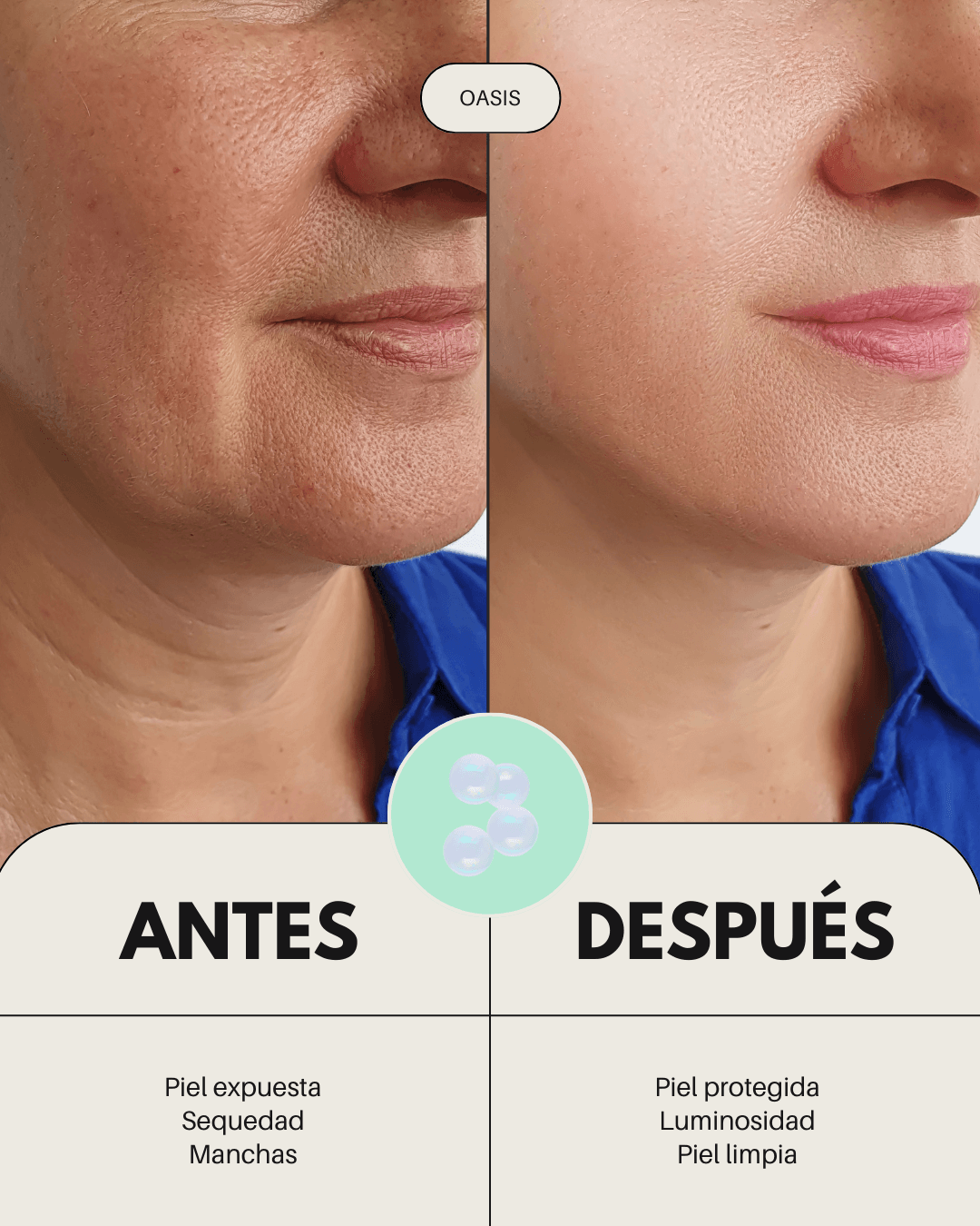 Comparativa de piel antes y después usando el tratamiento facial Oasis de Banbu para hidratar y revitalizar el rostro.