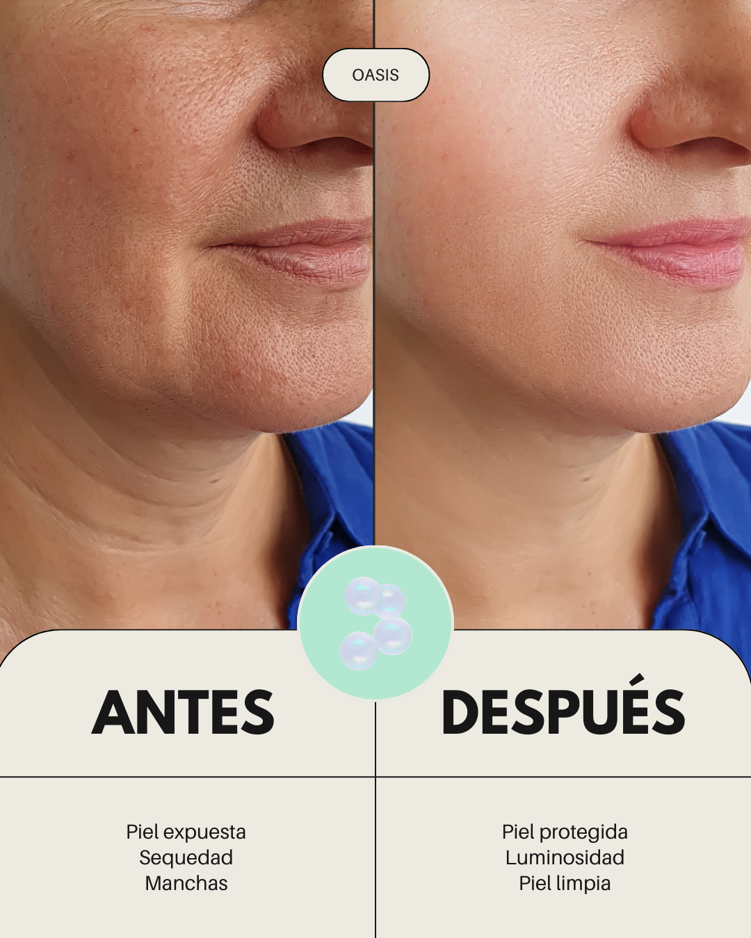 Comparativa "antes y después" de una rutina facial Banbu para piel seca: mejora visible en hidratación y suavidad.