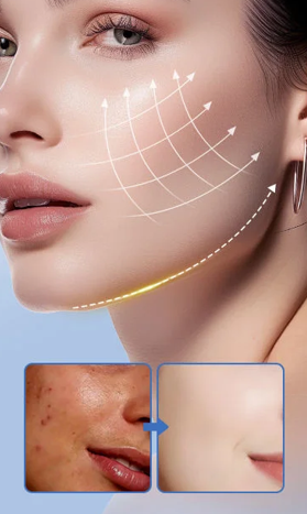 Primer plano de rostro femenino con líneas de efecto lifting y comparación de piel con y sin manchas para hidratación.